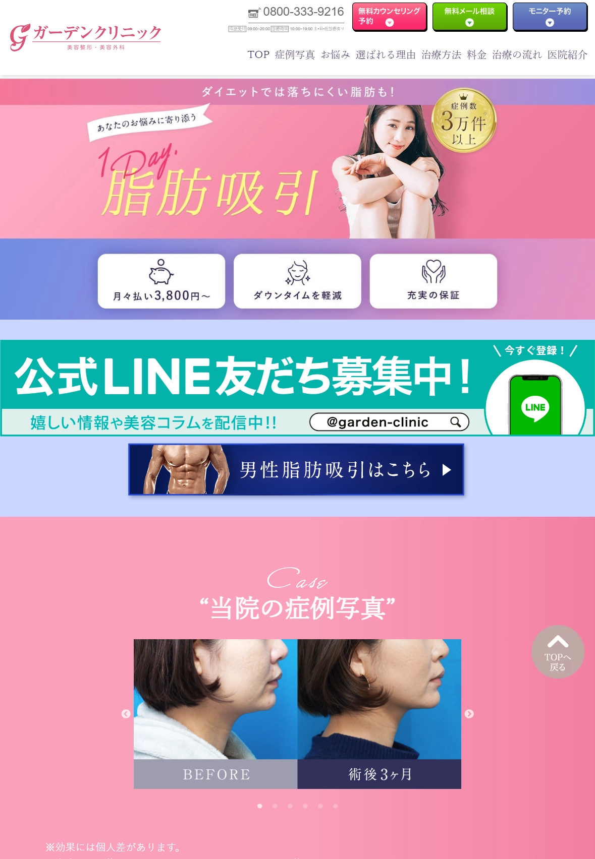 ランディングページサムネイル　脂肪の吸引｜ガーデンクリニック