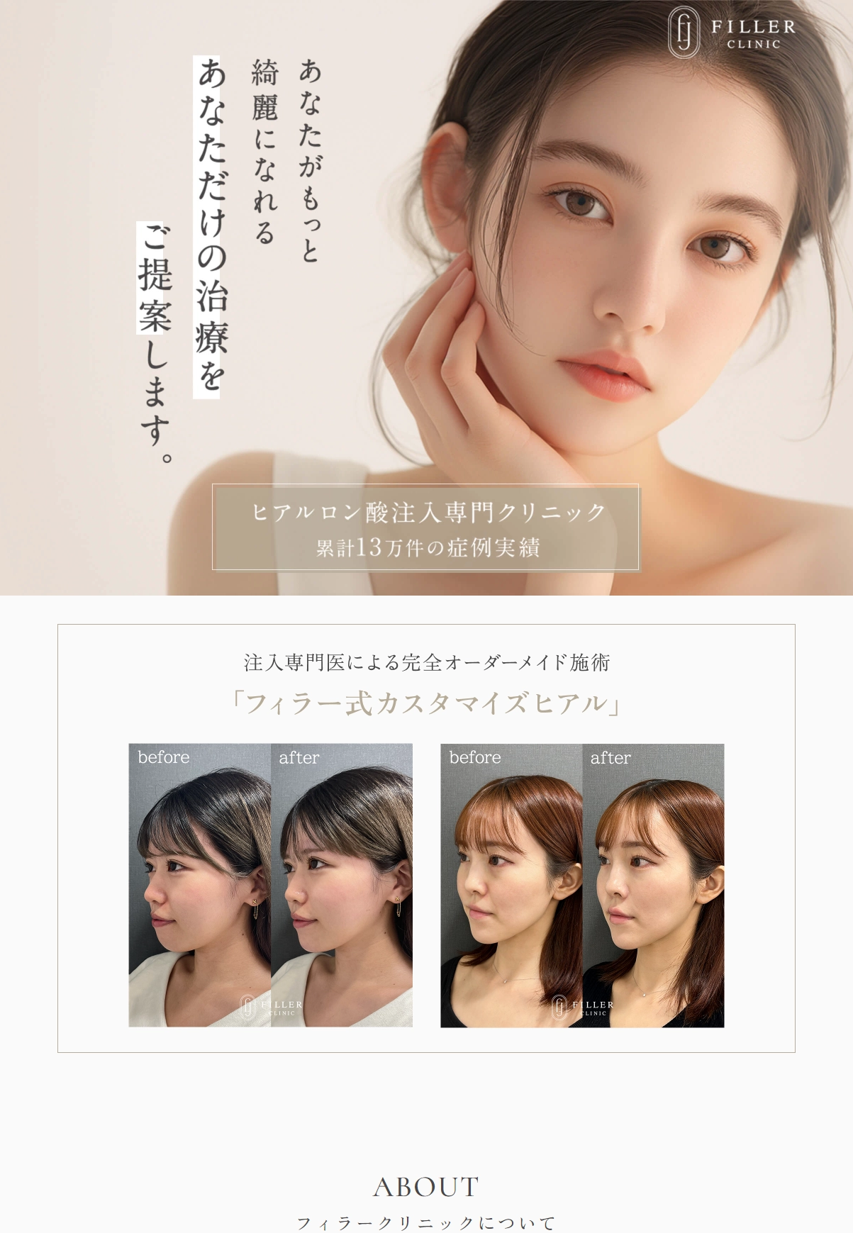 ランディングページサムネイル　カスタマイズヒアル|ヒアルロン酸、脂肪溶解注射はフィラークリニック