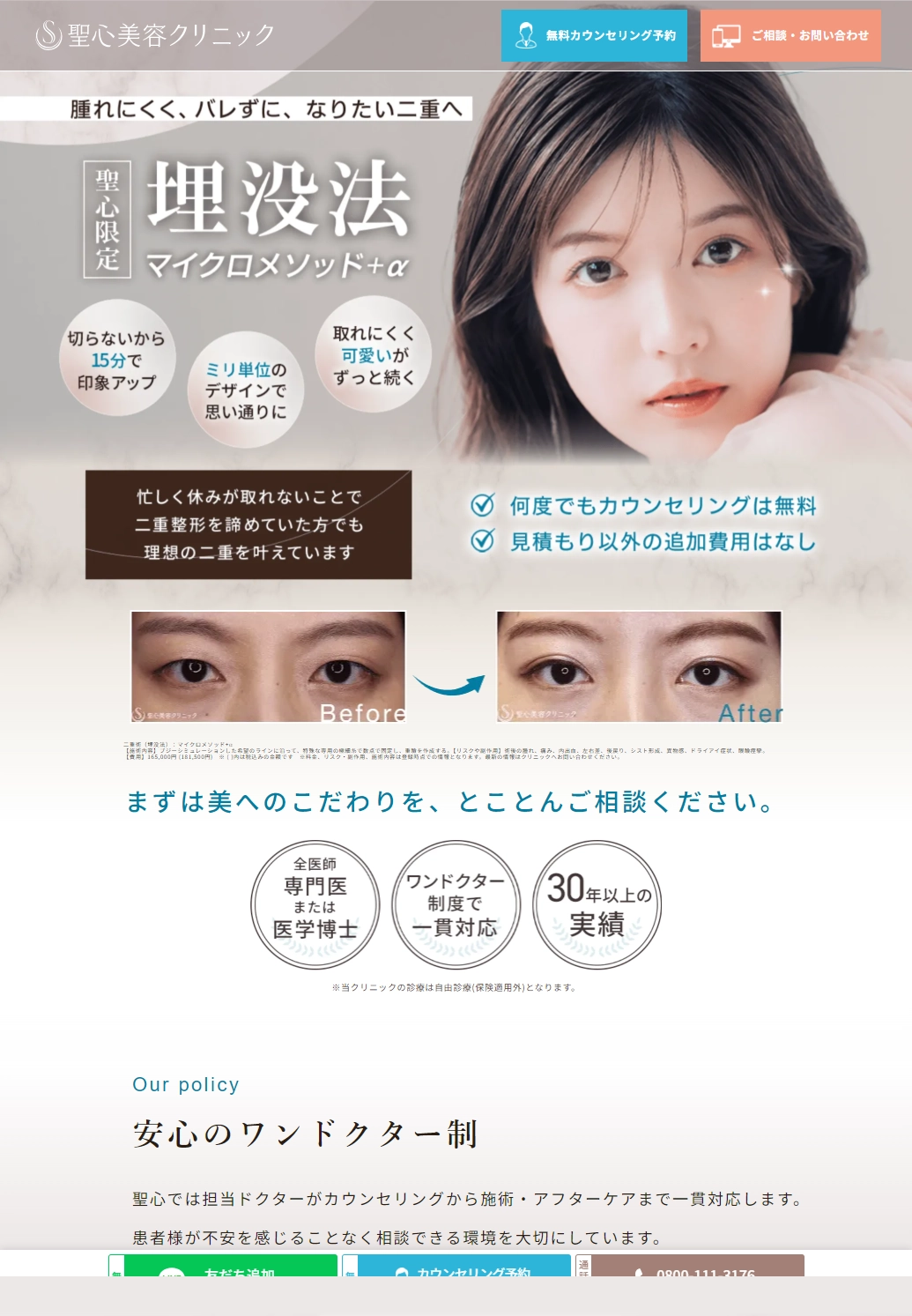 ランディングページサムネイル　二重整形（埋没法）：マイクロメソッド＋α | 腫れにくい・取れにくい・バレにくい・ダウンタイムが短い埋没法 | 美容整形、美容外科、美容皮膚科なら聖心美容クリニック
