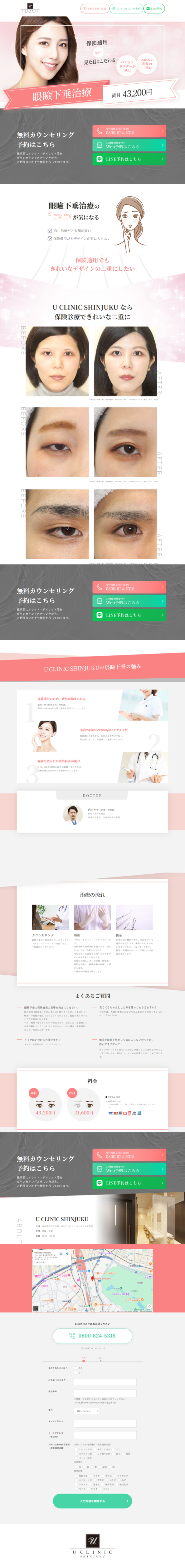 ランディングページ画像　眼瞼下垂治療｜Uクリニック