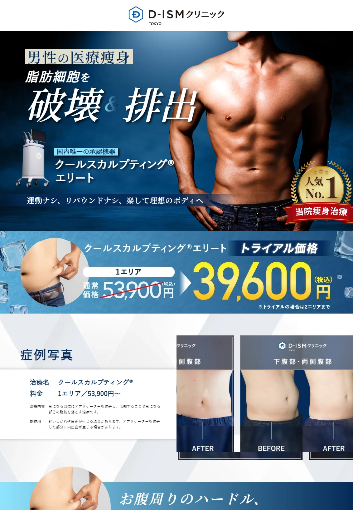 ランディングページサムネイル　【トライアル】クールスカルプティング® | ディズムクリニック東京-メンズ美容皮膚科･美容外科･再生医療