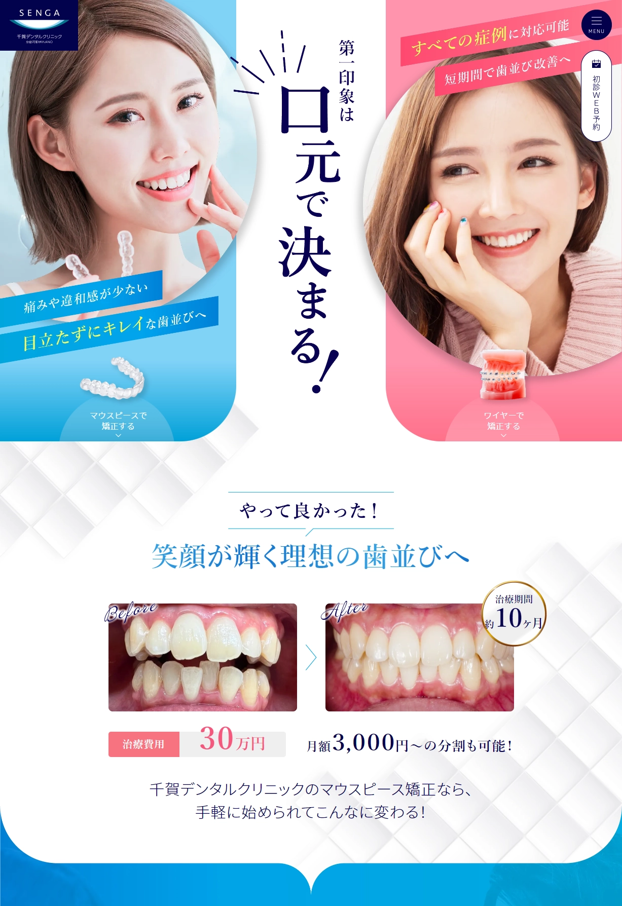 ランディングページサムネイル　矯正歯科・マウスピース矯正｜分倍河原の歯医者｜千賀デンタルクリニック分倍河原MINANO医院